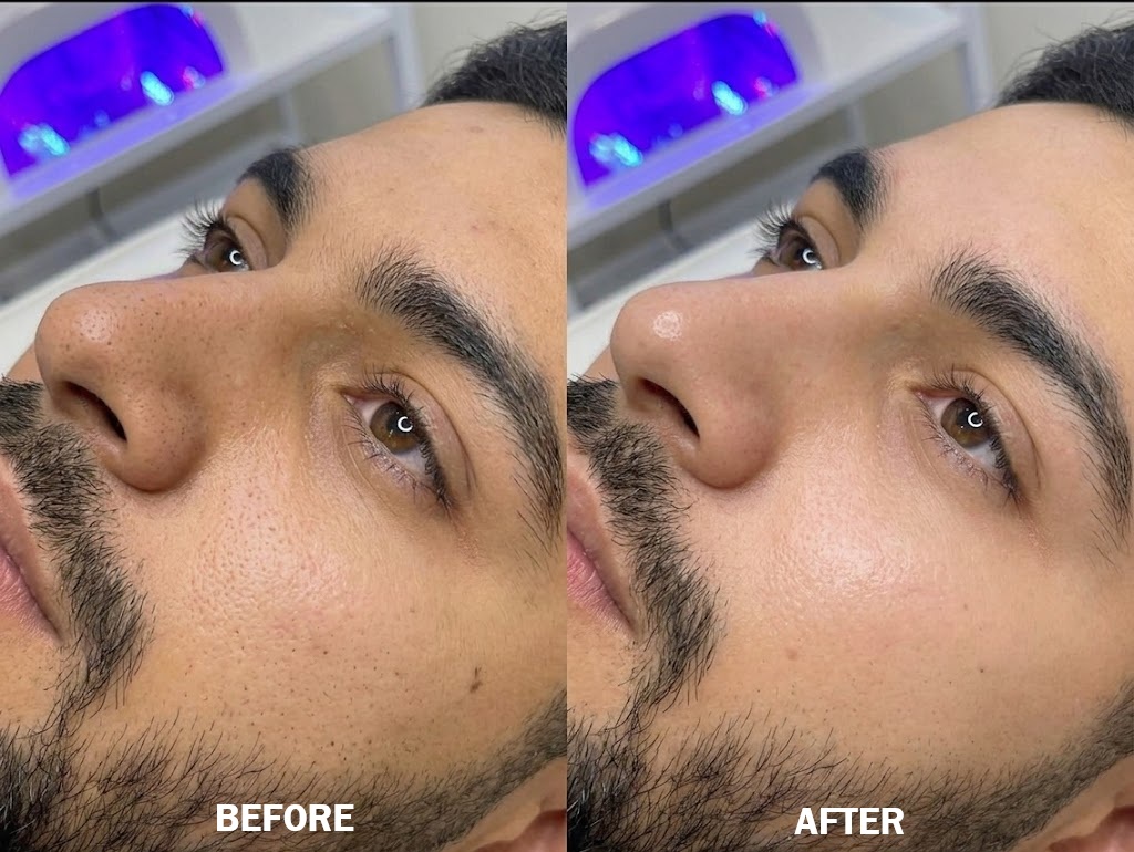 Deep Pore Cleansing Facial