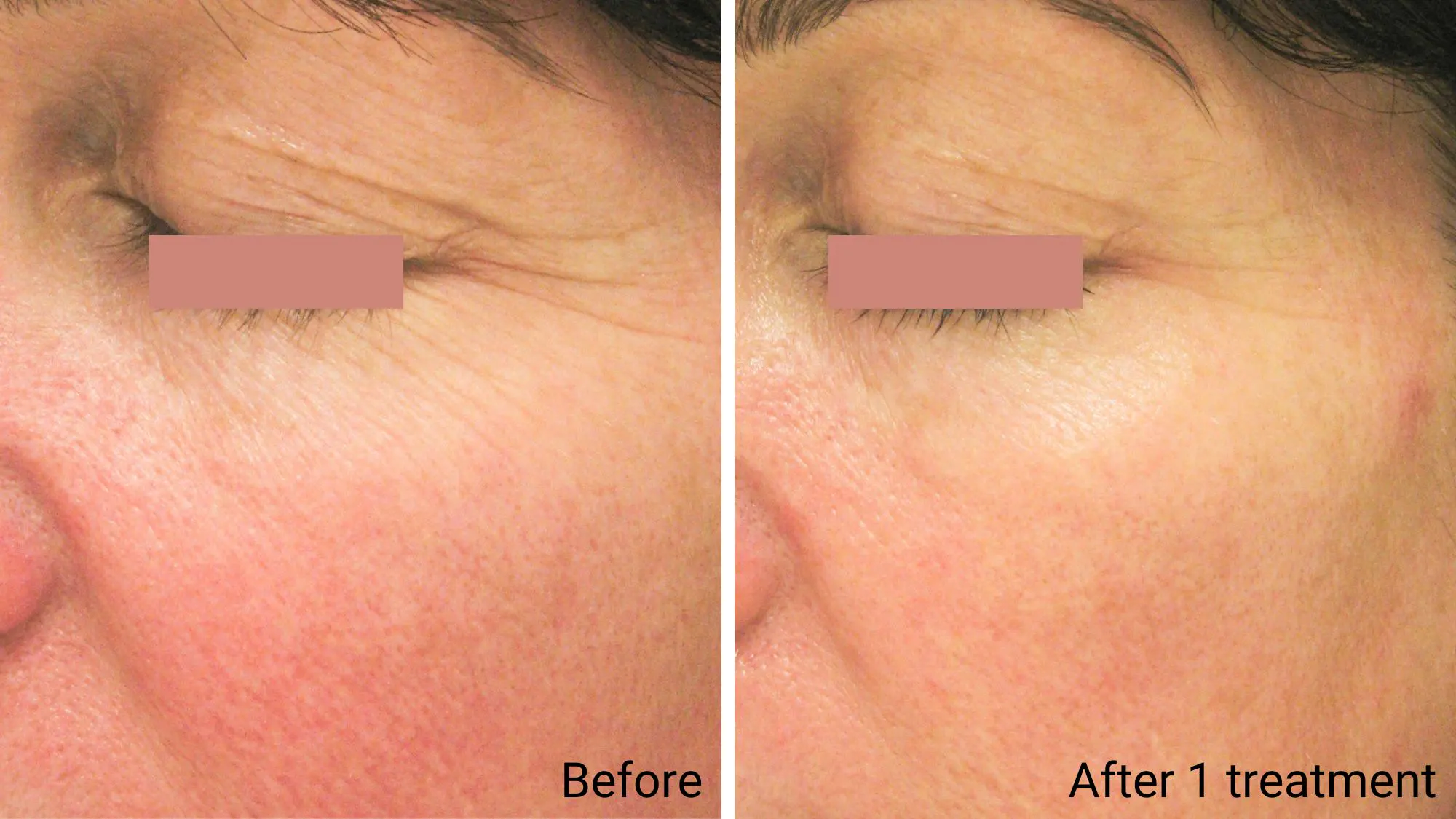 Firming Facial