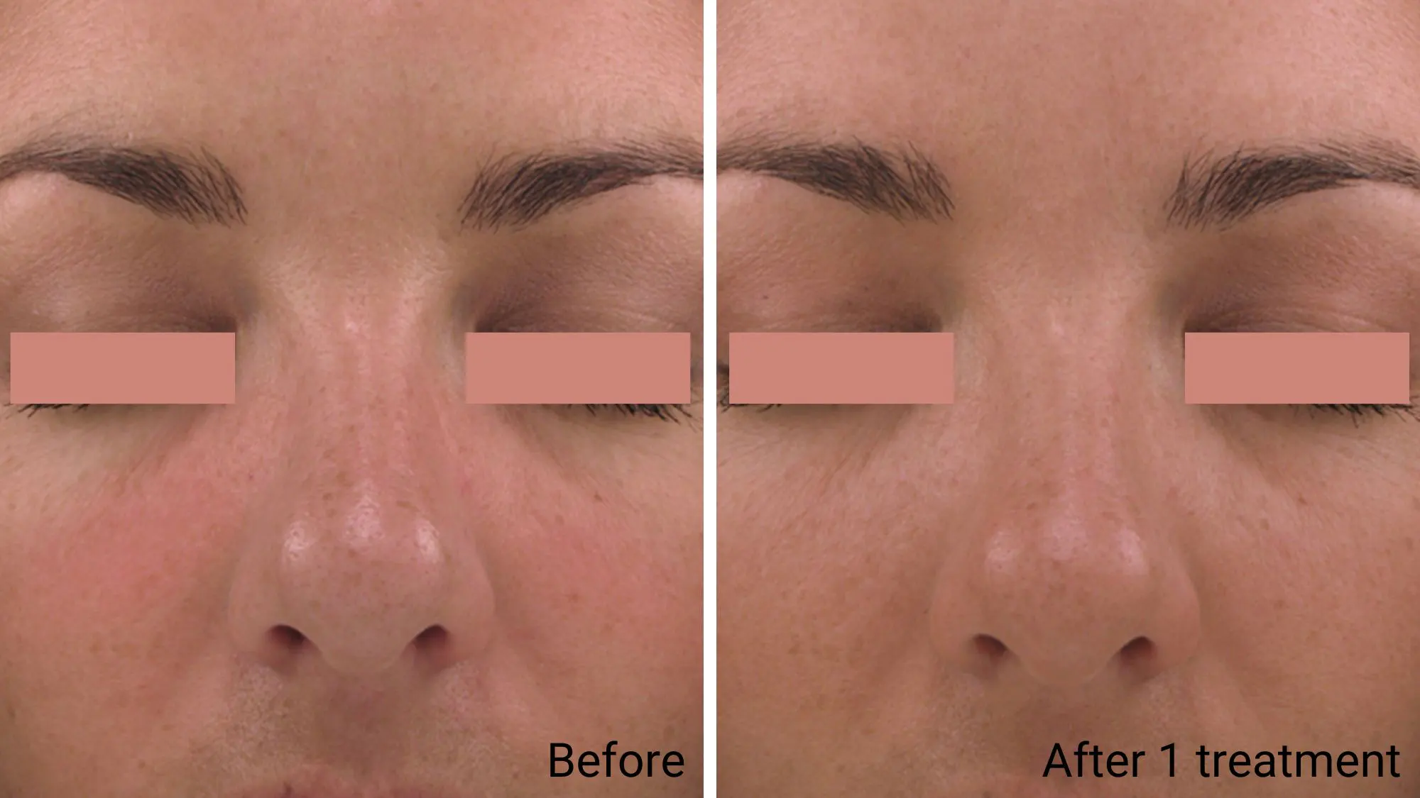 Hydrating Facial