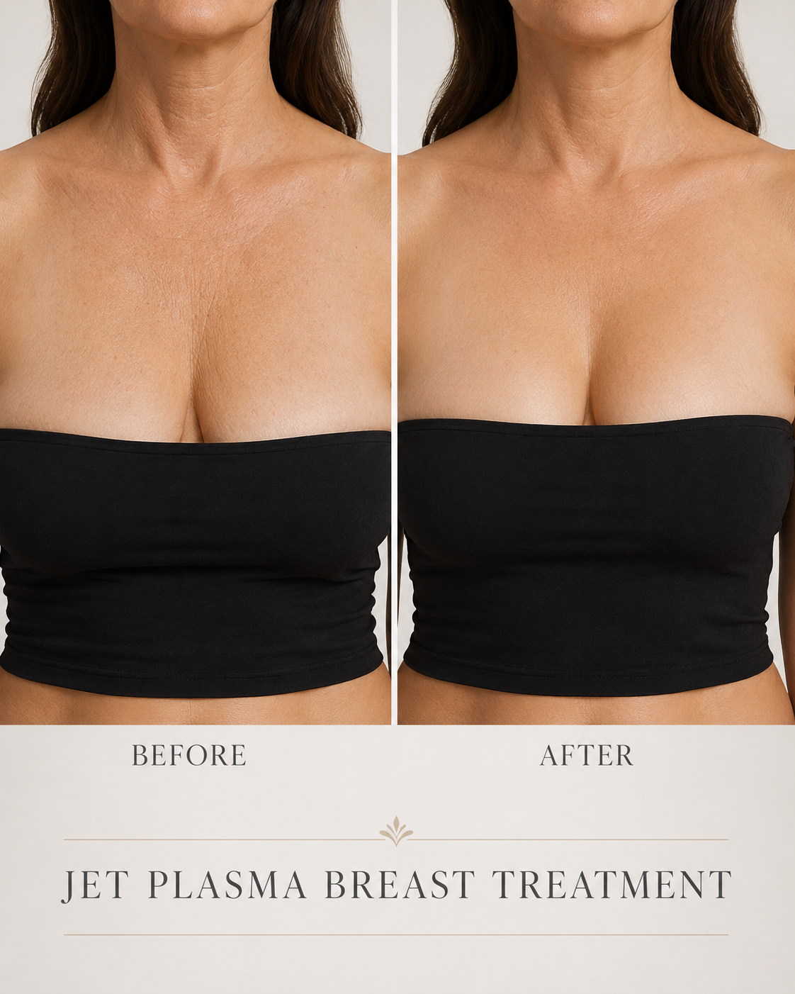 Jet Plasma Breast