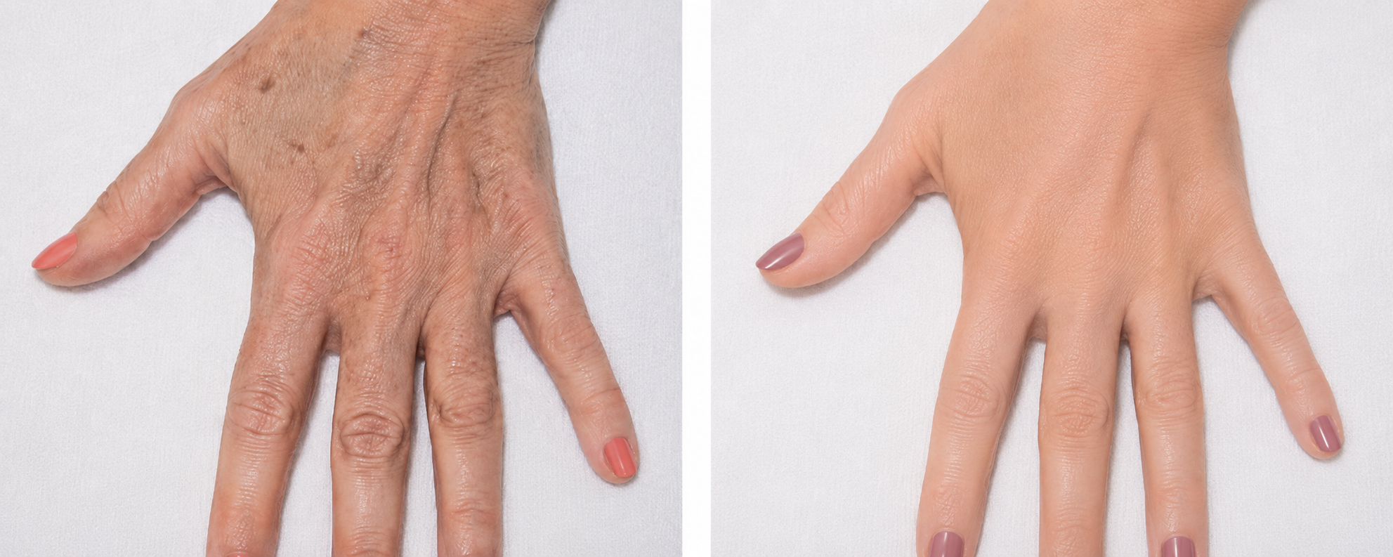 Jet Plasma Hand