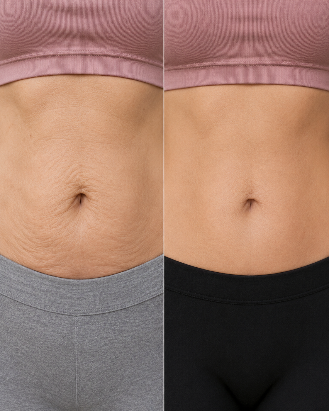 Jet Plasma Stomach