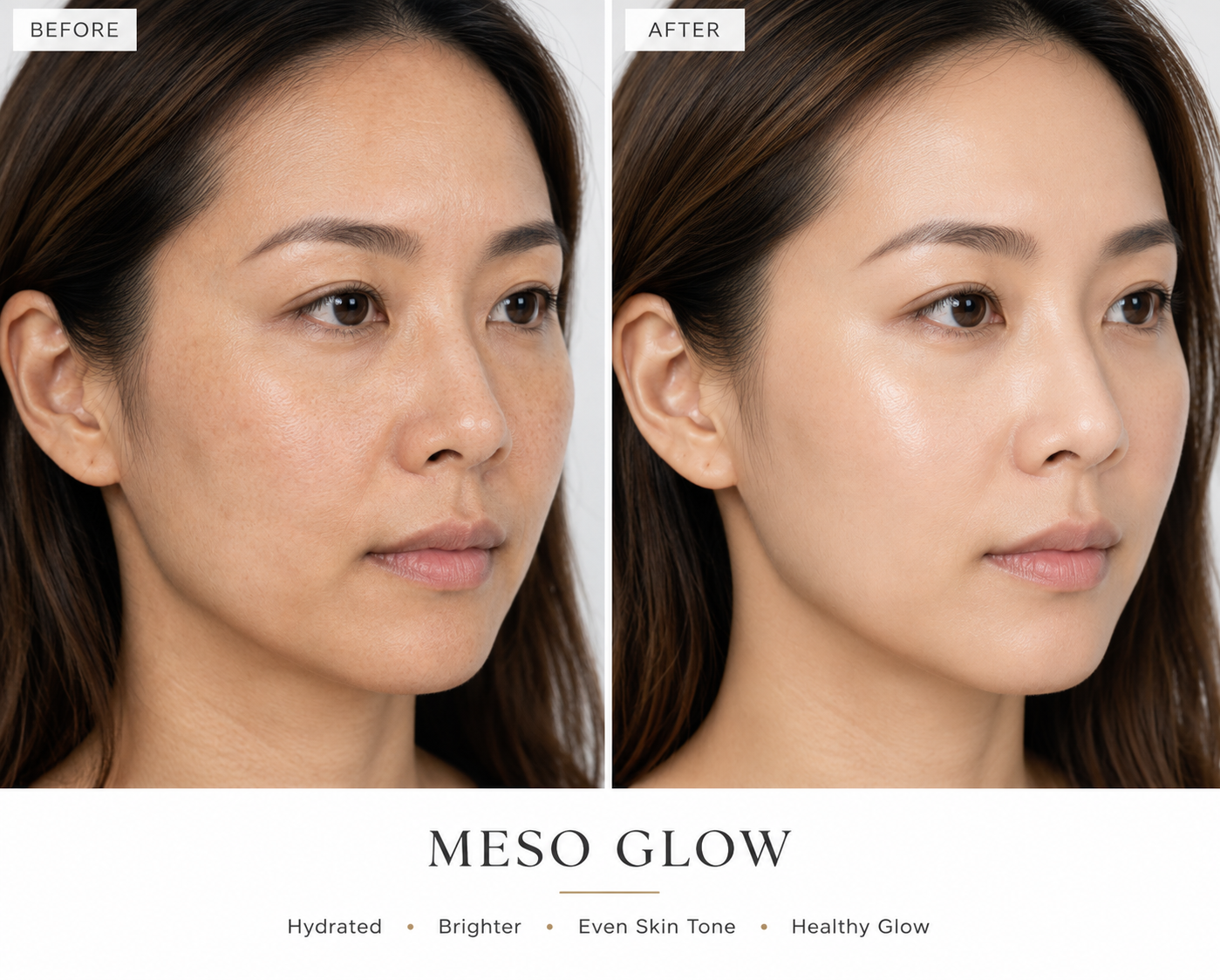 Meso Glow