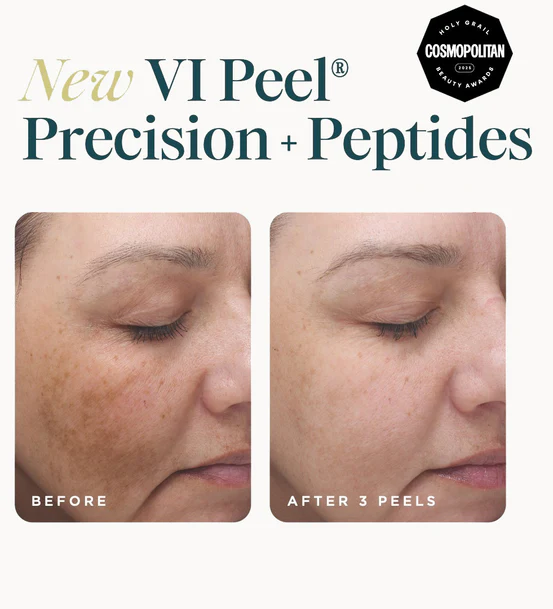 VIPeel